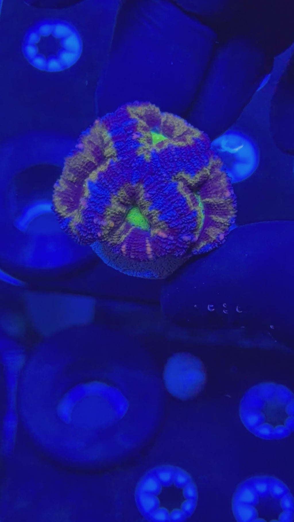 Ultra Acan